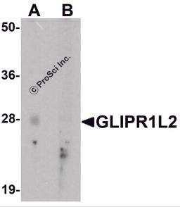 Western blot analysis of GLIPR1L2 in human testis tissue lysate with GLIPR1L2 antibody at 1 &#956;g/ml in (A) the absence and (B) the presence of blocking peptide.