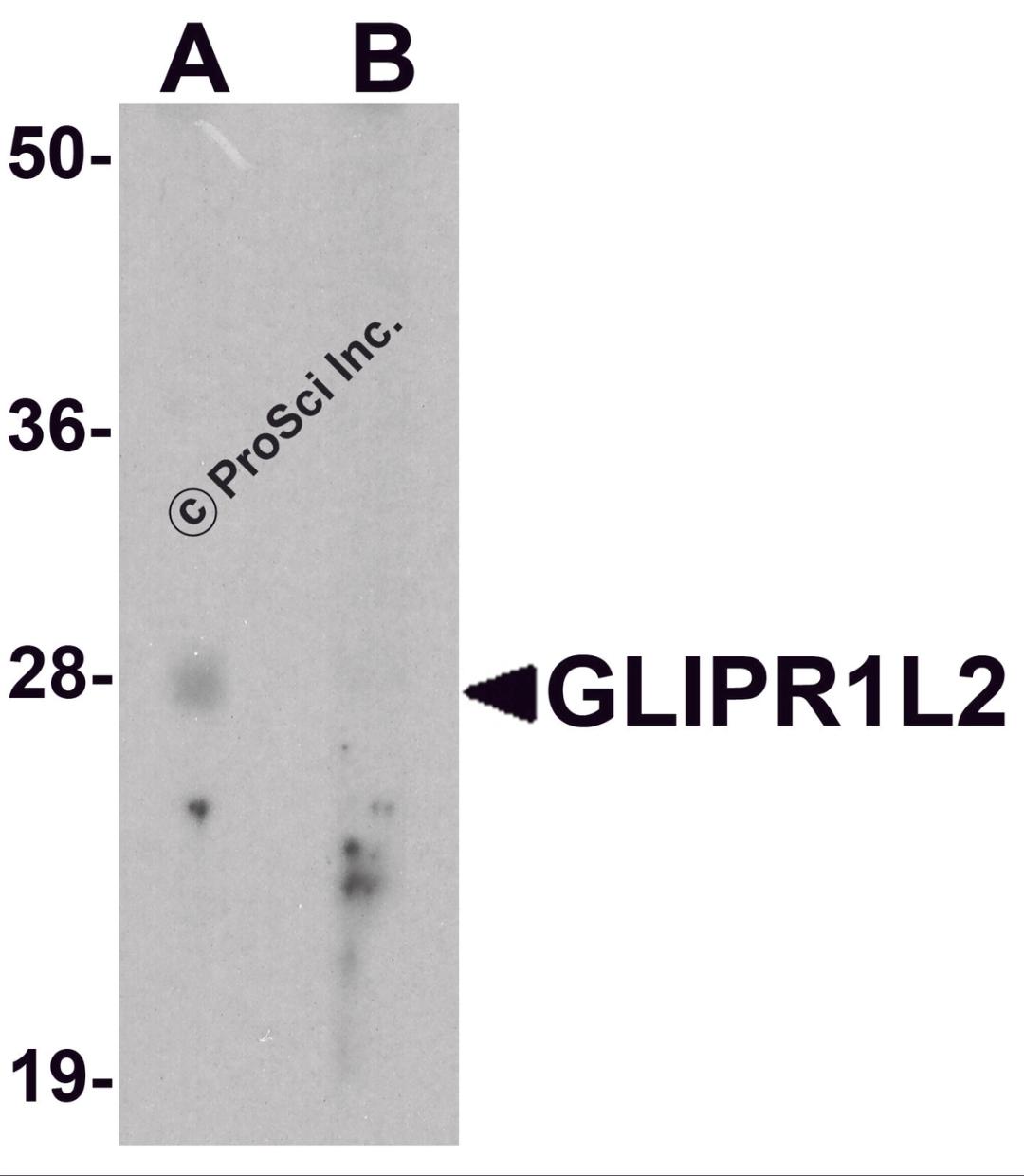 Western blot analysis of GLIPR1L2 in human testis tissue lysate with GLIPR1L2 antibody at 1 μg/ml in (A) the absence and (B) the presence of blocking peptide.
