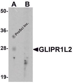 Western blot analysis of GLIPR1L2 in human testis tissue lysate with GLIPR1L2 antibody at 1 μg/ml in (A) the absence and (B) the presence of blocking peptide.