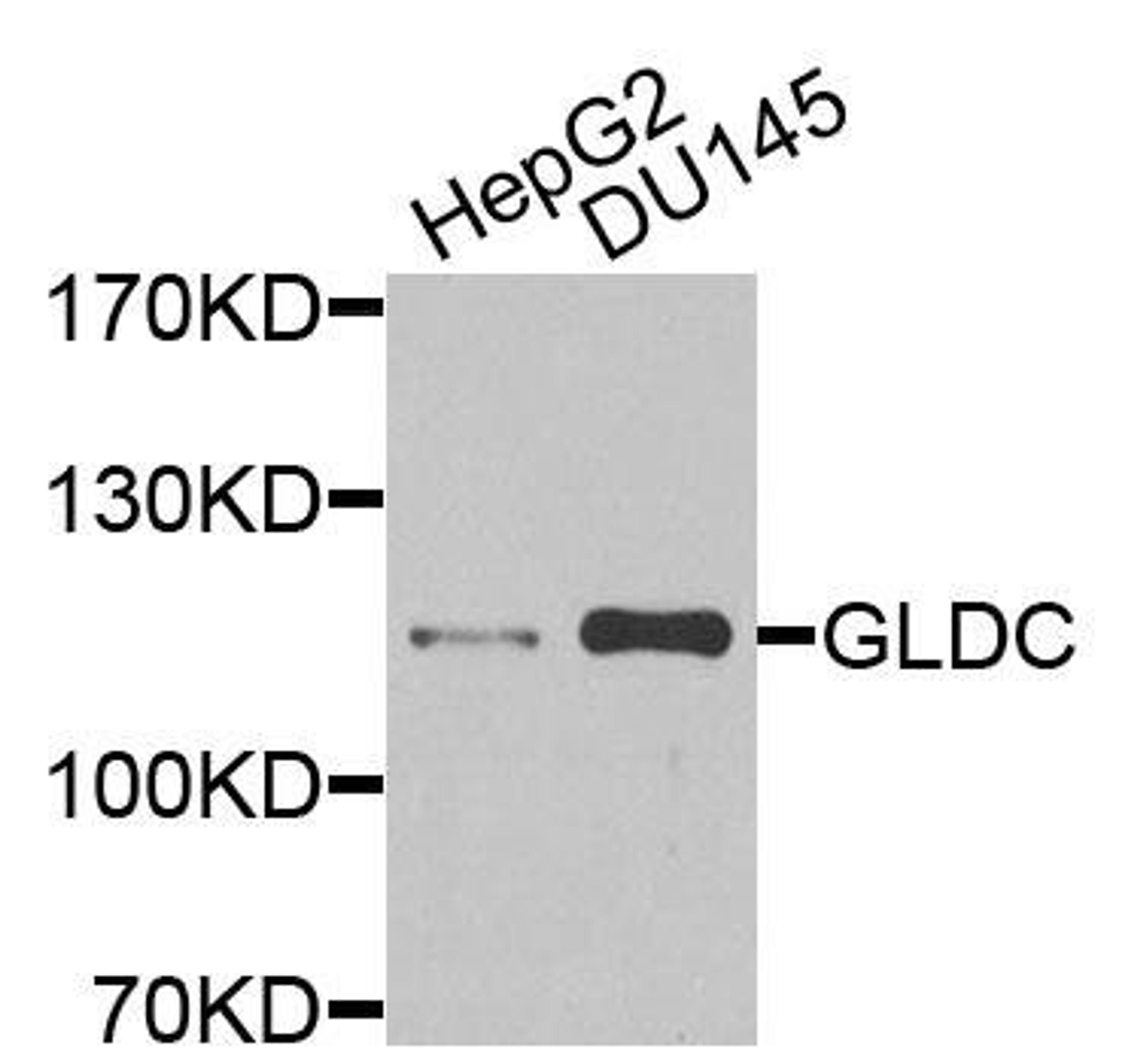 Western blot analysis of extracts of various cells using GLDC antibody