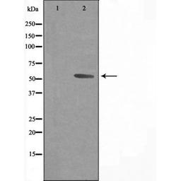 Western blot analysis of Jurkat cells using 3A43 (Cytochrome P450) antibody