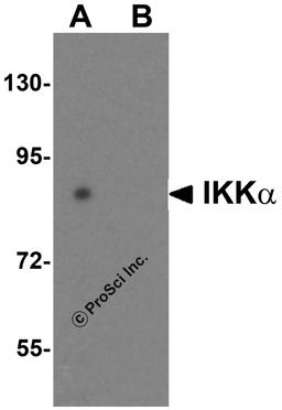 Western blot analysis of IKK alpha in HeLa cell lysate with IKK alpha antibody at 1 μg/mL in (A) the absence and (B) the presence of blocking peptide.