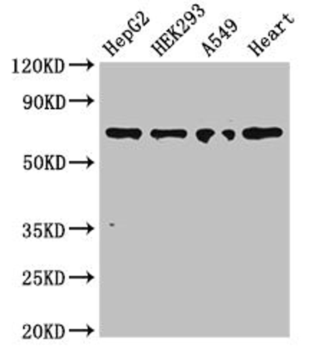 Western Blot. Positive WB detected in: HepG2 whole cell lysate, HEK293 whole cell lysate, A549 whole cell lysate, Mouse heart tissue. All lanes: TRIM5 antibody at 3ug/ml. Secondary. Goat polyclonal to rabbit IgG at 1/50000 dilution. Predicted band size: 57, 47, 41, 38, 32, 30 kDa. Observed band size: 70 kDa.