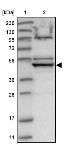 Western Blot: BLU Antibody [NBP1-89958] - Lane 1: Marker [kDa] 230, 130, 95, 72, 56, 36, 28, 17, 11<br/>Lane 2: Human cell line RT-4