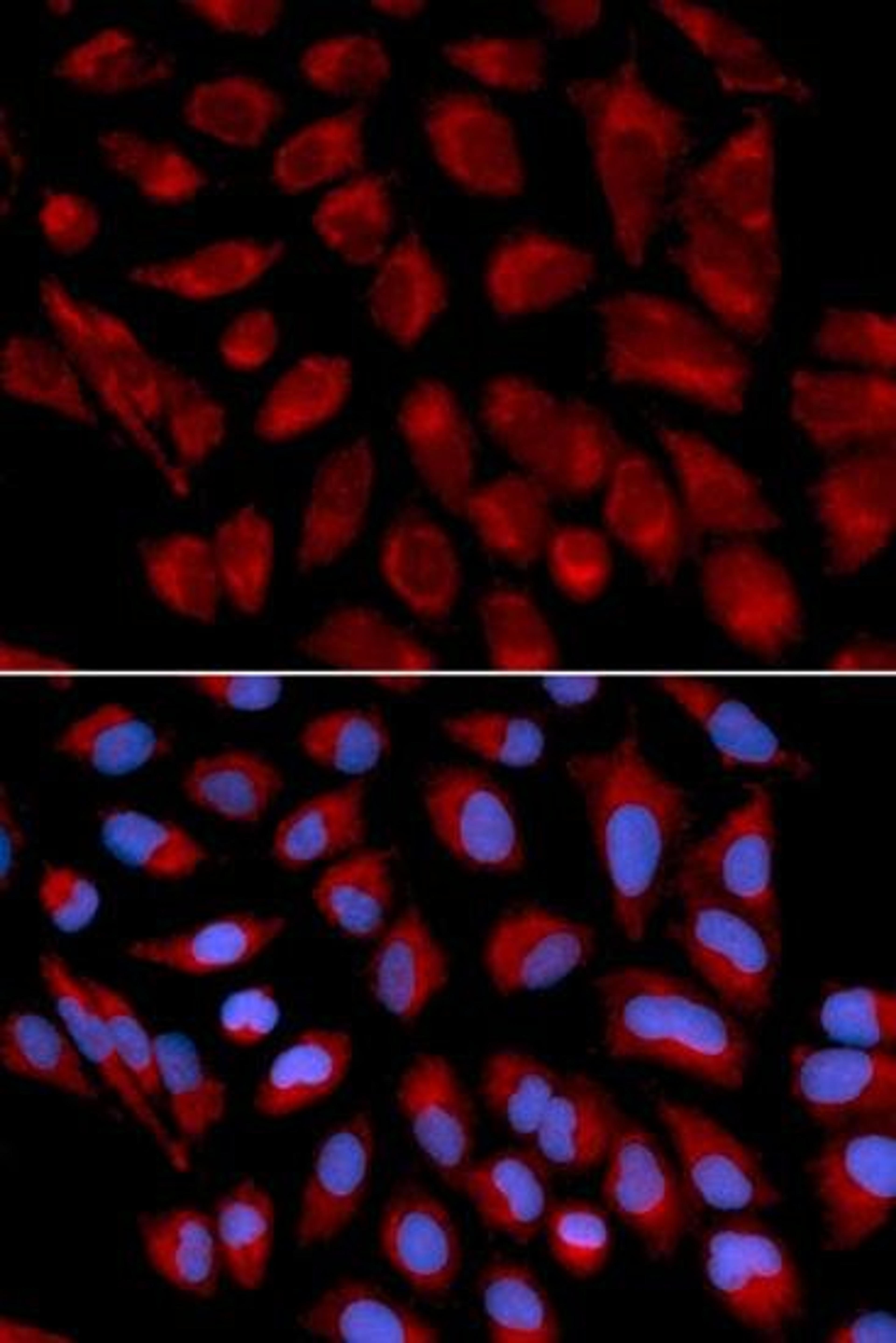 Immunofluorescense analysis of U2OS cell using AIFM1 antibody