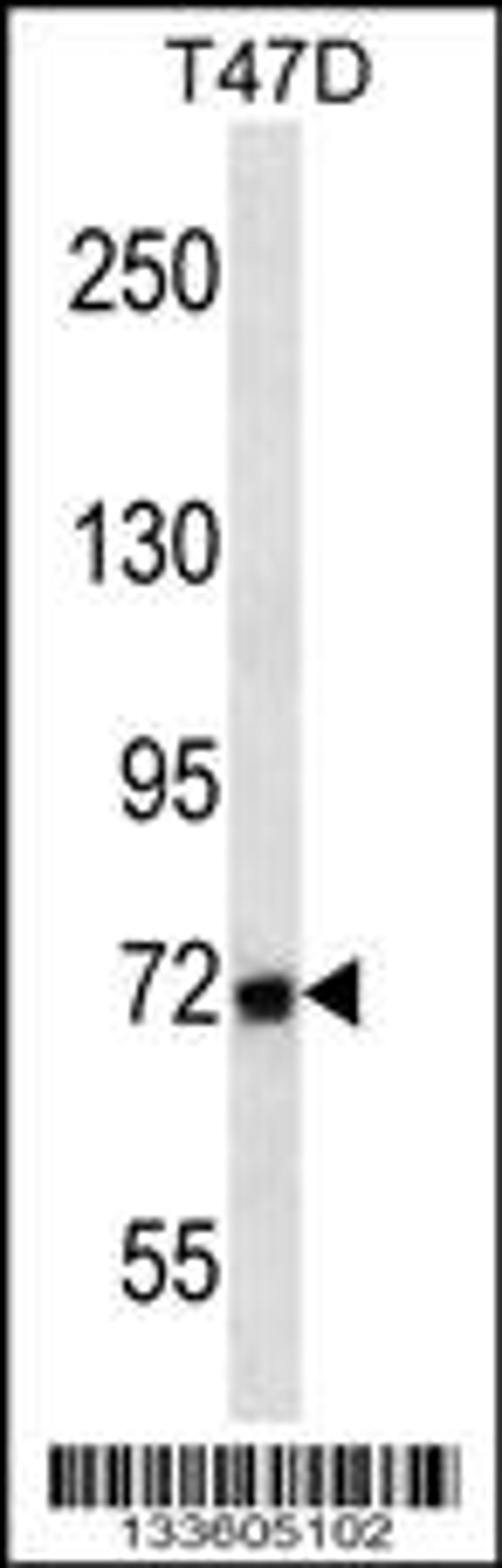 Western blot analysis in T47D cell line lysates (35ug/lane).