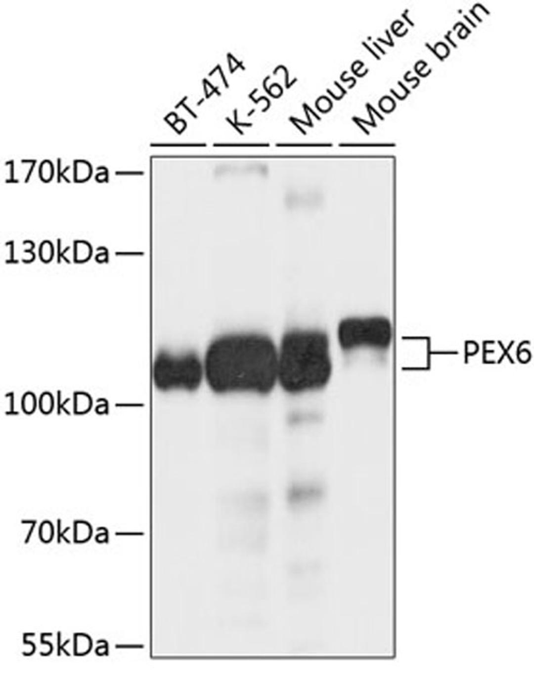 Western blot - PEX6 antibody (A10459)