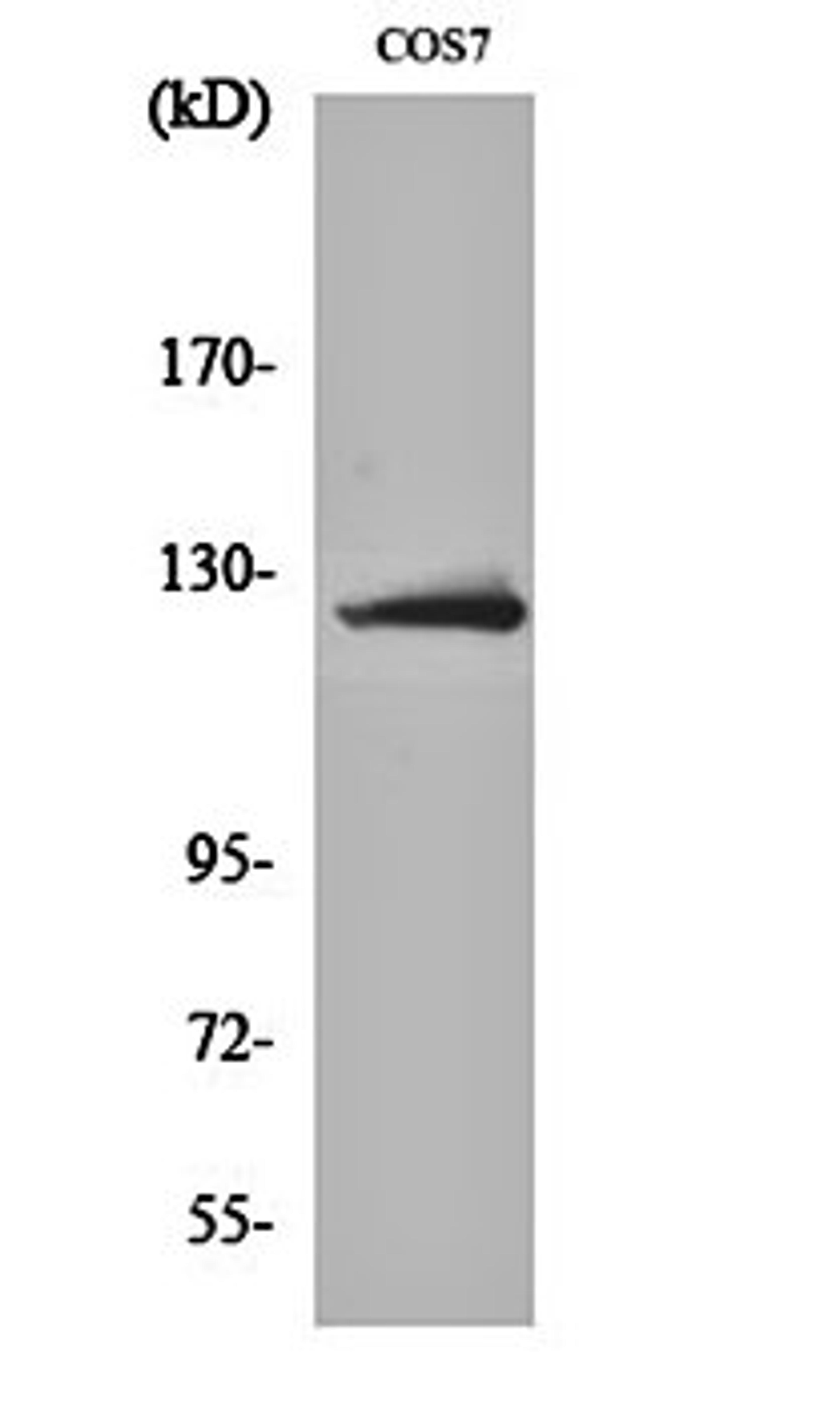 Western blot analysis of COS7 cell lysates using ATP-citrate synthase antibody