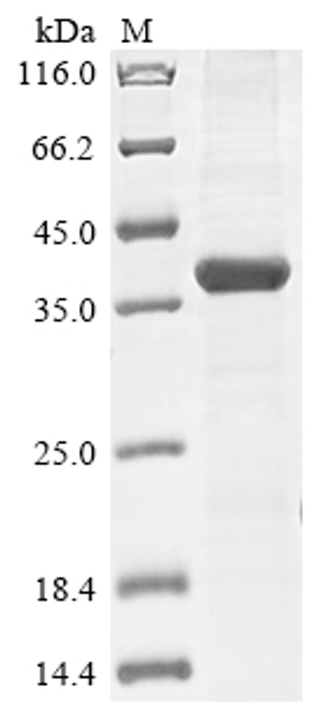 (Tris-Glycine gel) Discontinuous SDS-PAGE (reduced) with 5% enrichment gel and 15% separation gel.