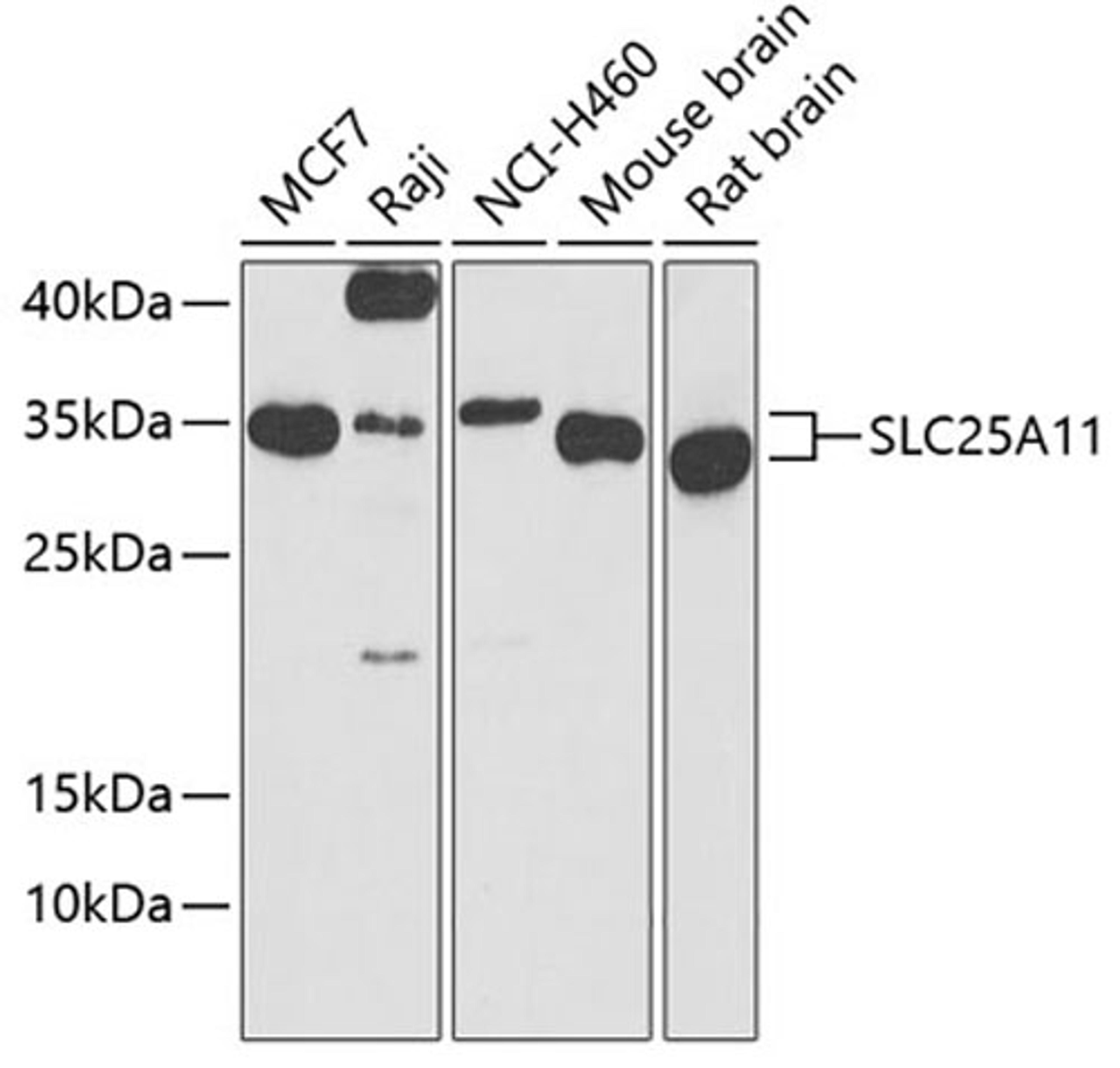 Western blot - SLC25A11 antibody (A8163)