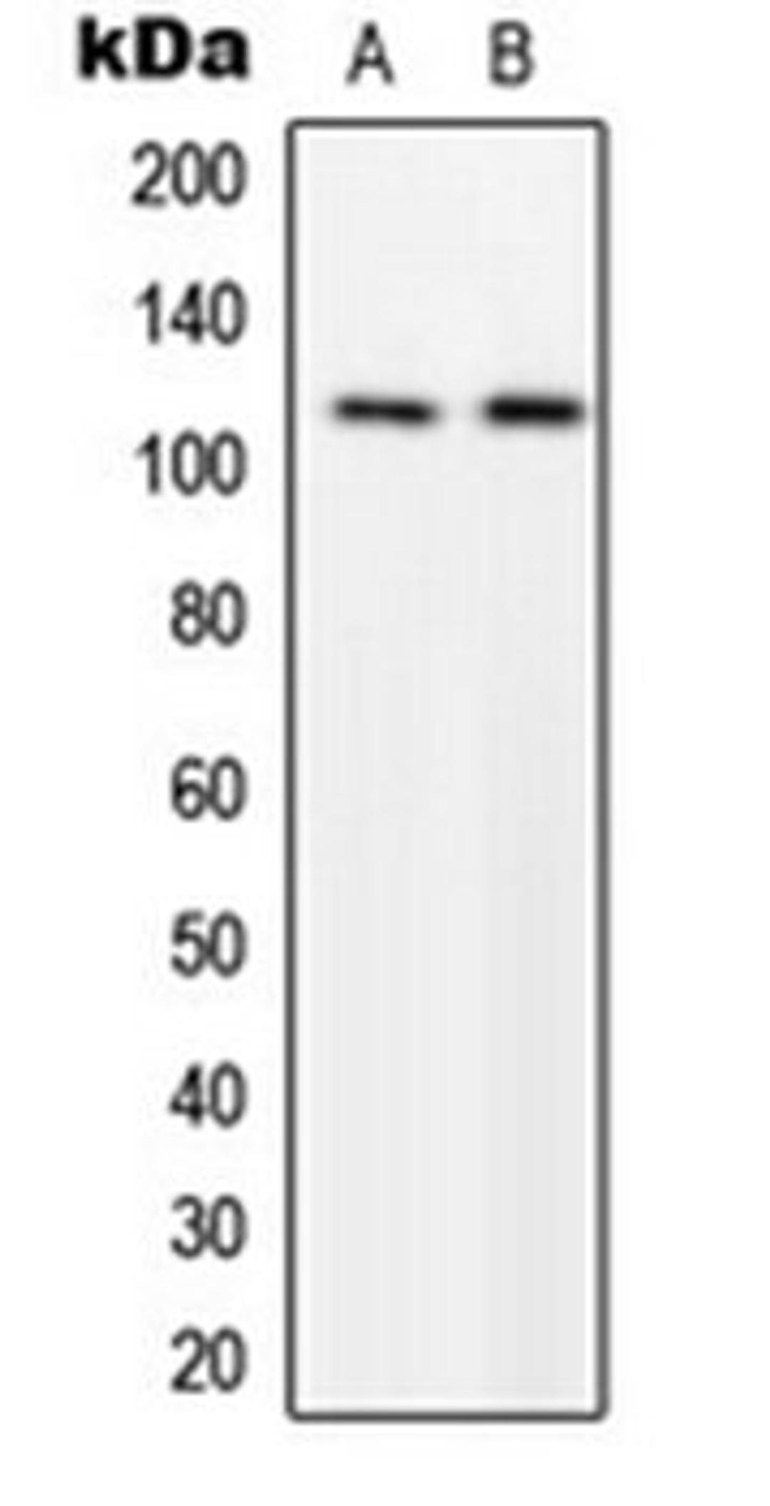 Western blot analysis of U251MG (Lane 1), NIH3T3 (Lane 2) whole cell lysates using p116 Rip antibody