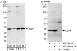 Detection of human CDK1 by western blot and immunoprecipitation.