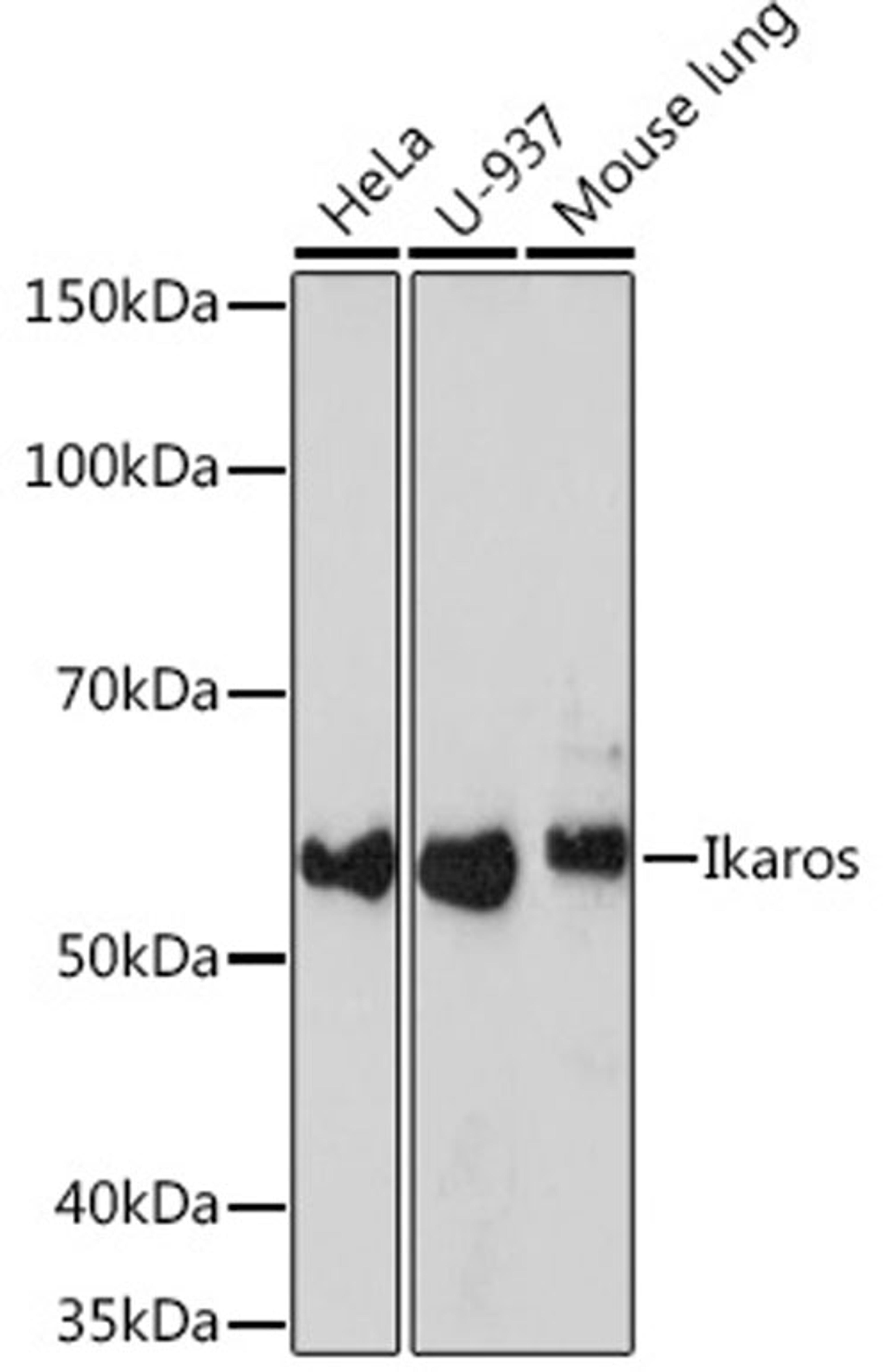 Western blot - Ikaros Rabbit mAb (A3565)