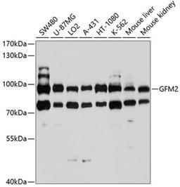 Western blot - GFM2 antibody (A10158)