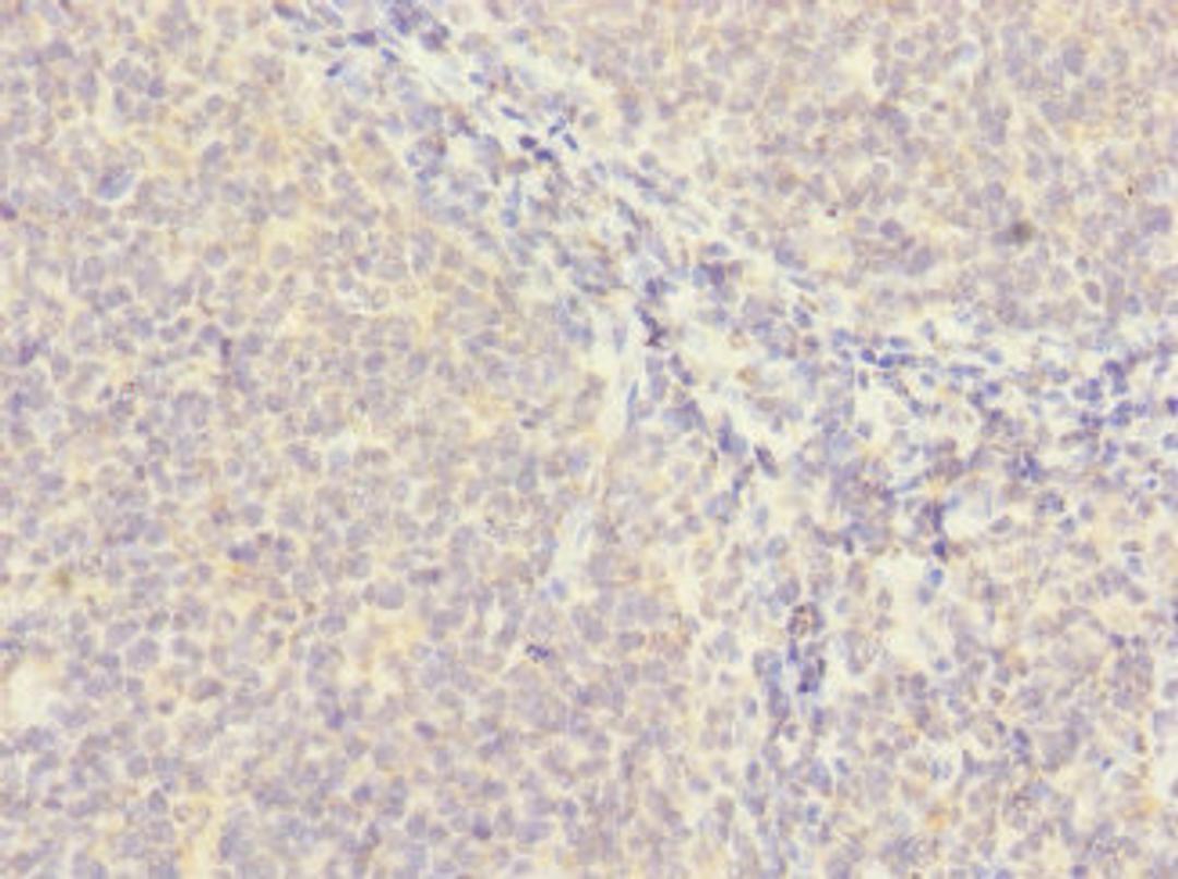 Immunohistochemistry of paraffin-embedded human tonsil tissue using CSB-PA822238LA01HU at dilution of 1:100