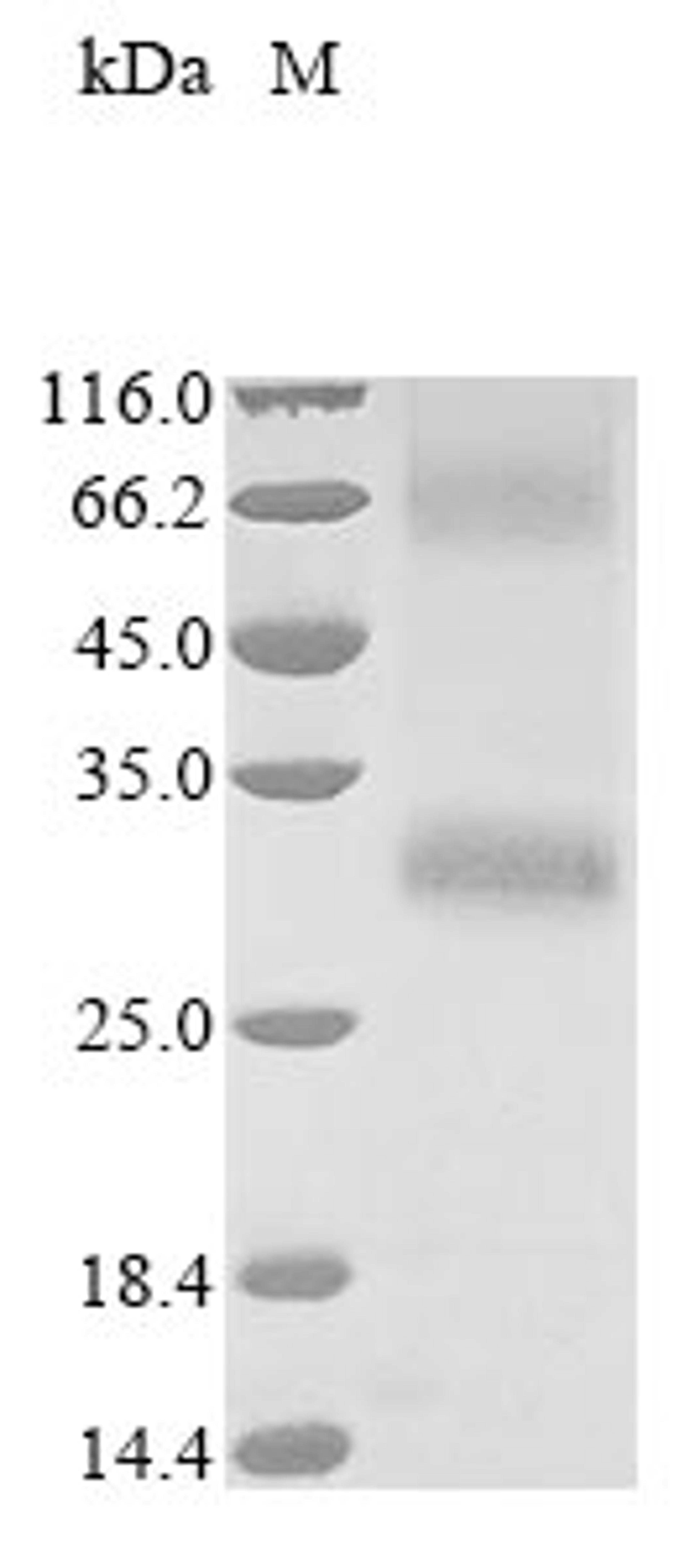 (Tris-Glycine gel) Discontinuous SDS-PAGE (reduced) with 5% enrichment gel and 15% separation gel.
