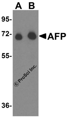 Western blot analysis of AFP in fetal human liver tissue lysate with AFP antibody at (A) 1 μg/mL and (B) 2 μg/mL.
