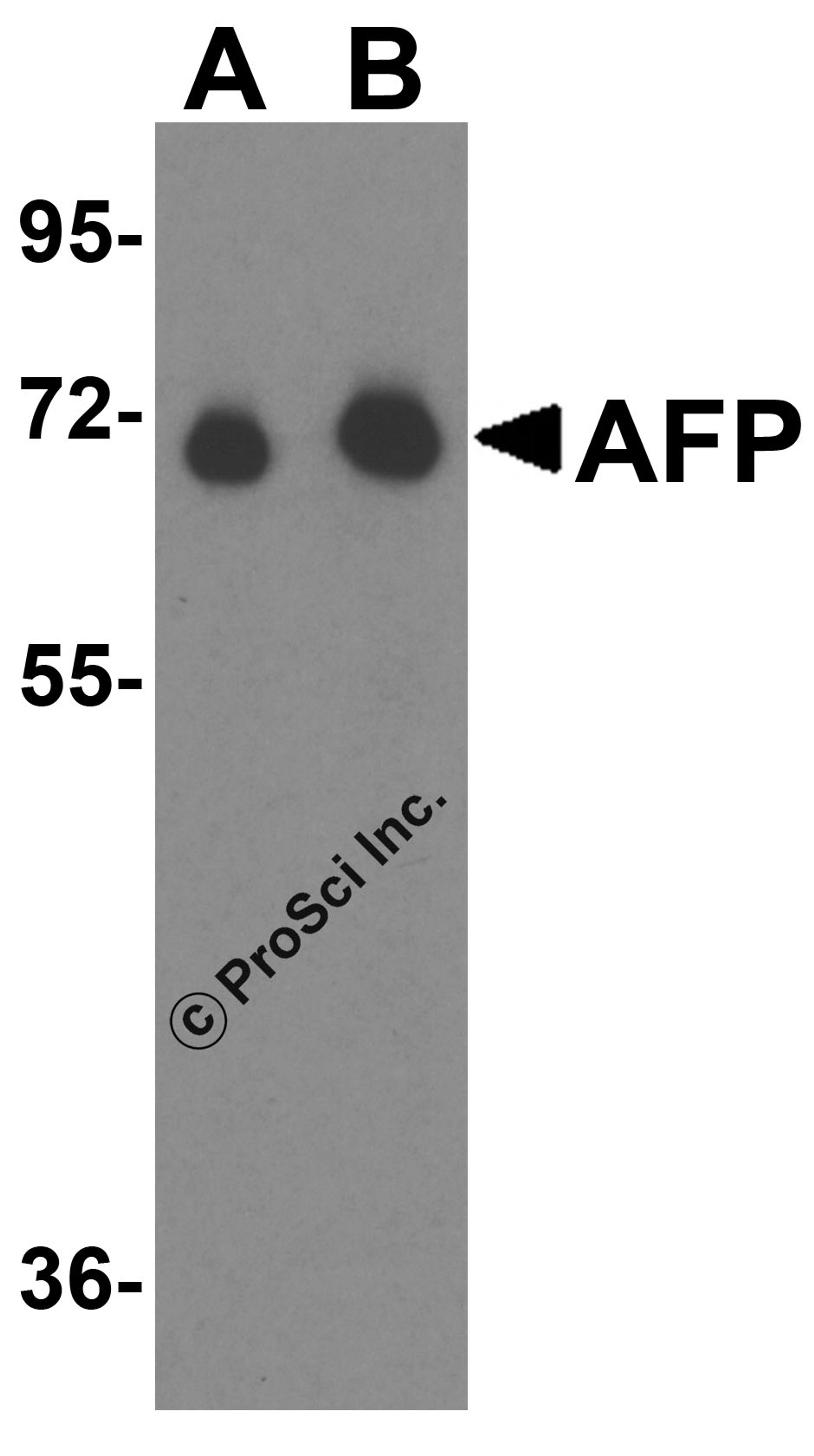 Western blot analysis of AFP in fetal human liver tissue lysate with AFP antibody at (A) 1 μg/mL and (B) 2 μg/mL.