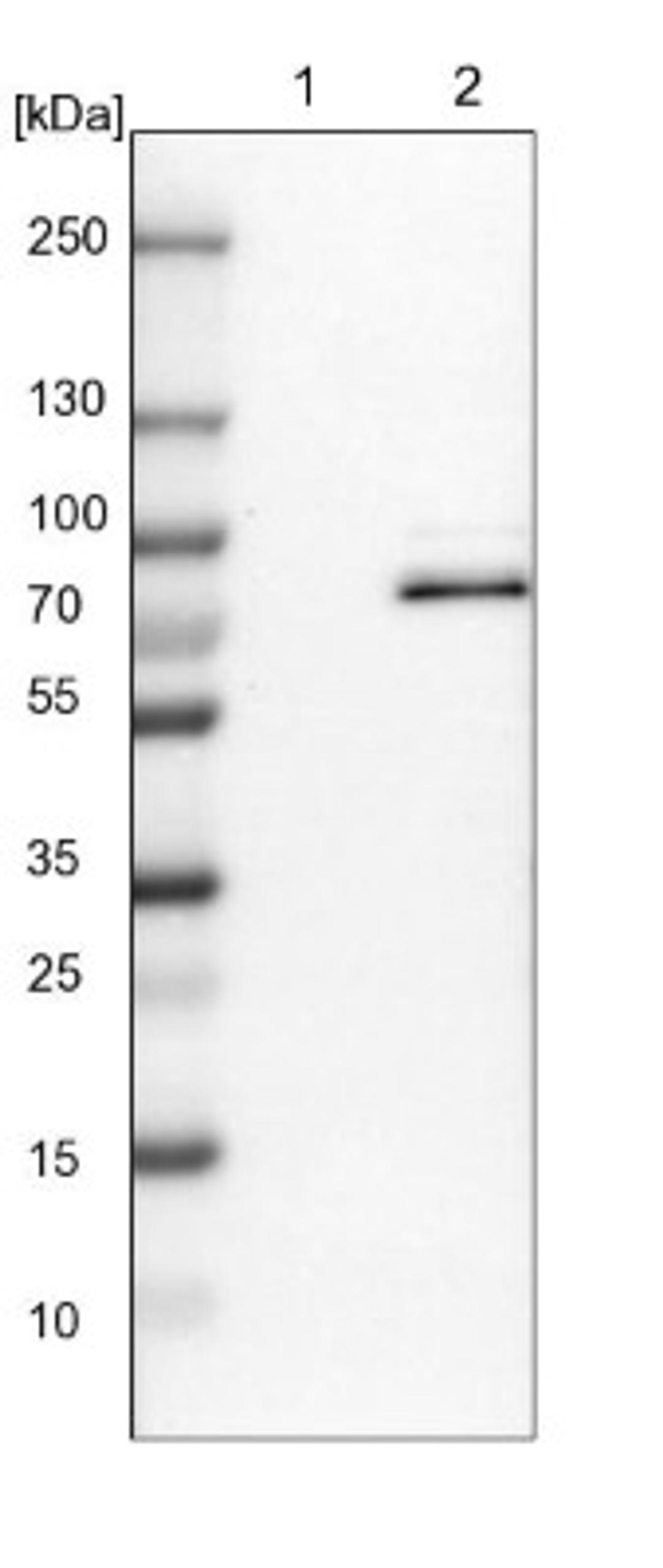 Western Blot: RAP1GAP2 Antibody [NBP1-93721] - Lane 1: NIH-3T3 cell lysate (Mouse embryonic fibroblast cells)<br/>Lane 2: NBT-II cell lysate (Rat Wistar bladder tumour cells)