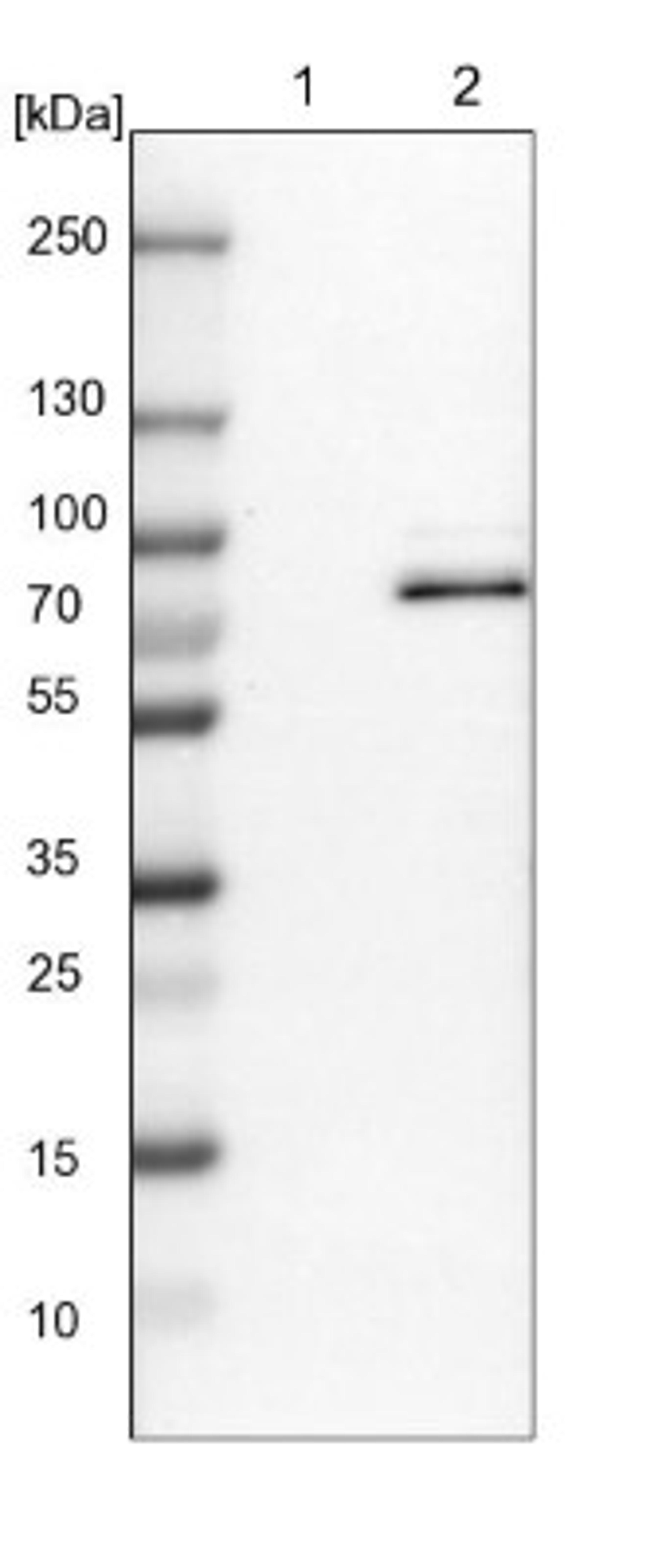 Western Blot: RAP1GAP2 Antibody [NBP1-93721] - Lane 1: NIH-3T3 cell lysate (Mouse embryonic fibroblast cells)<br/>Lane 2: NBT-II cell lysate (Rat Wistar bladder tumour cells)