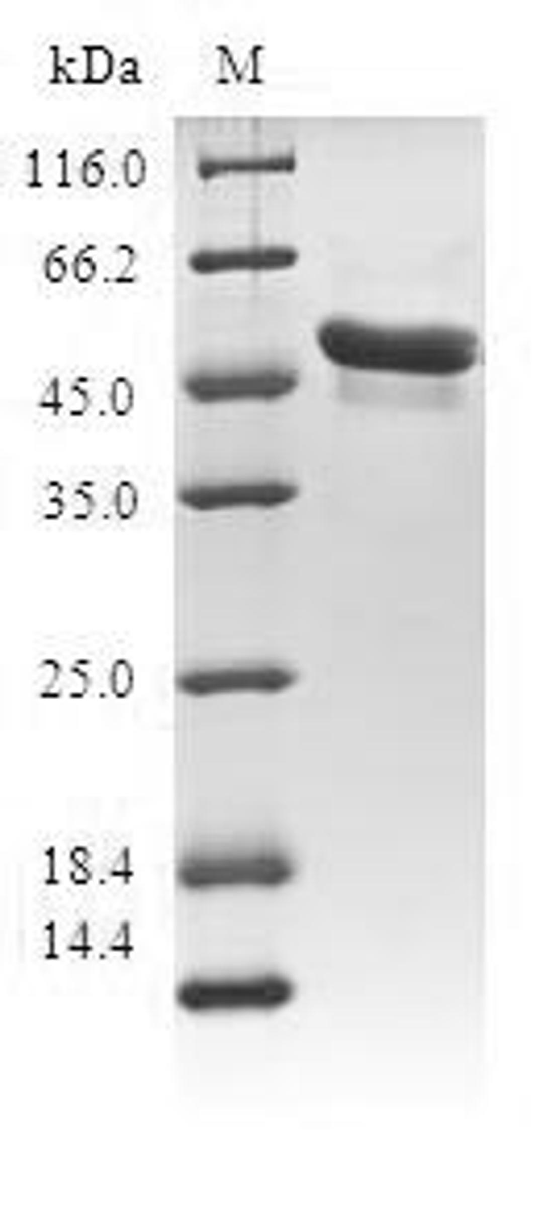 (Tris-Glycine gel) Discontinuous SDS-PAGE (reduced) with 5% enrichment gel and 15% separation gel.
