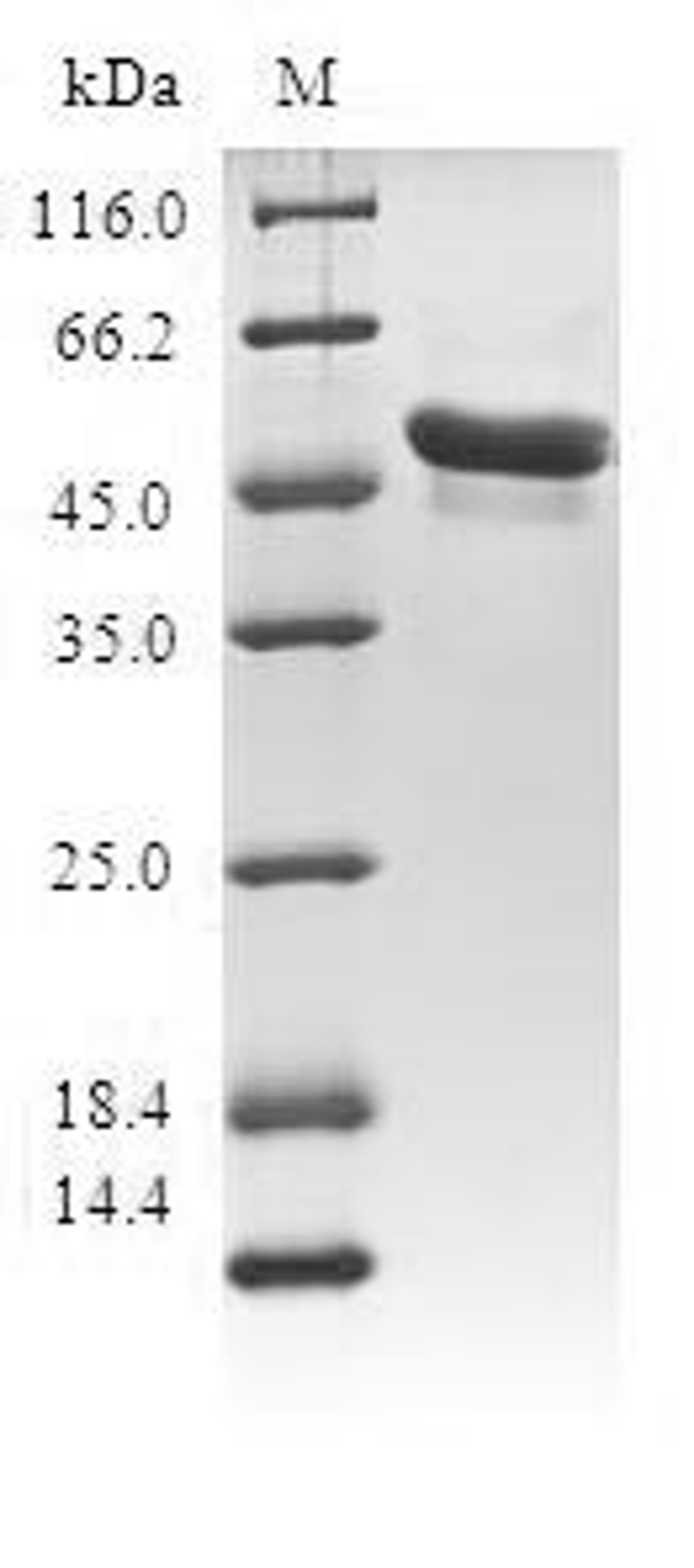 (Tris-Glycine gel) Discontinuous SDS-PAGE (reduced) with 5% enrichment gel and 15% separation gel.