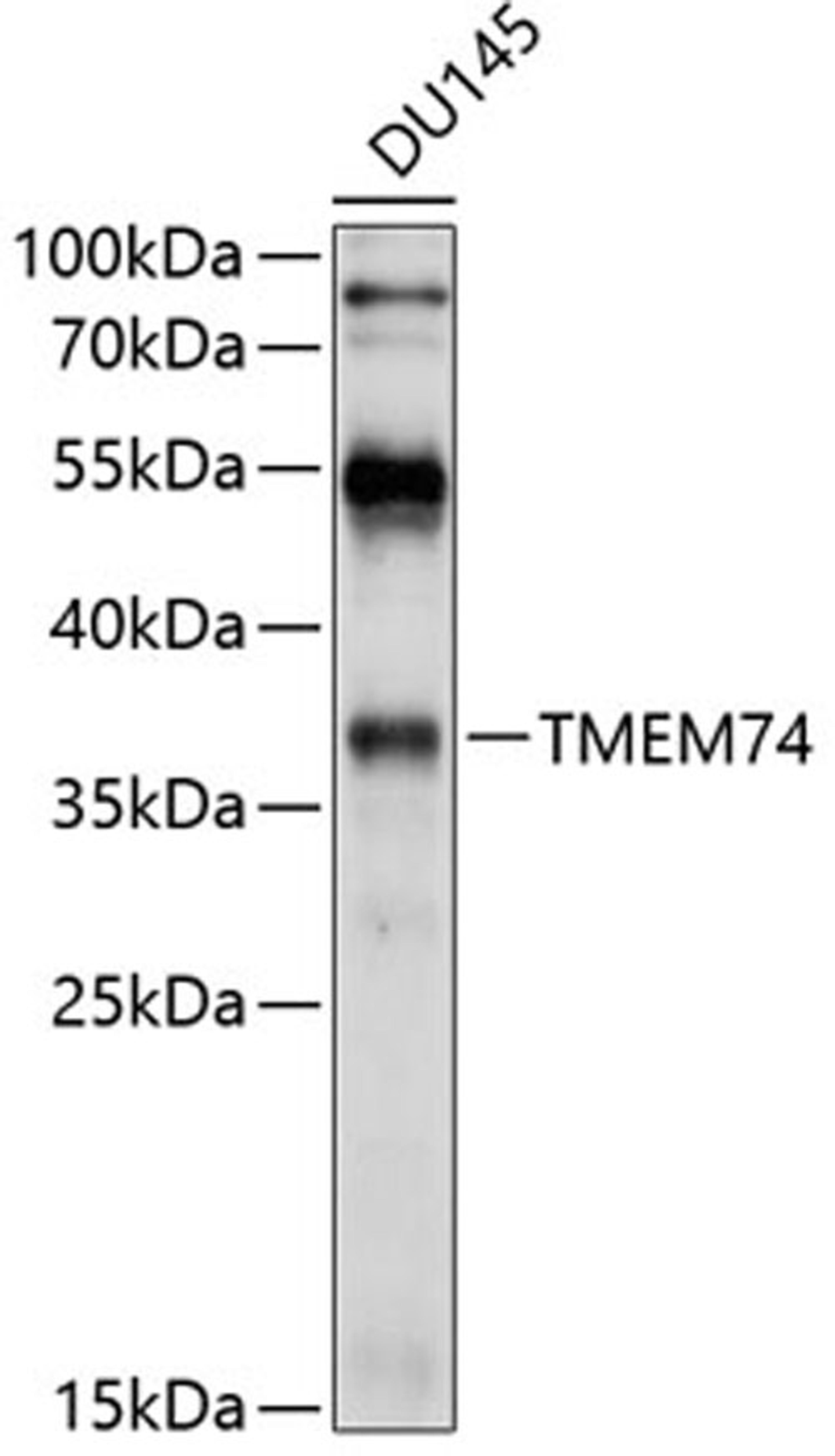 Western blot - TMEM74 antibody (A10379)