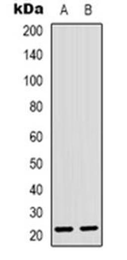 Western blot analysis of CD300d expression in U2OS (Lane 1), NIH3T3 (Lane 2) whole cell lysates using CD300LD antibody