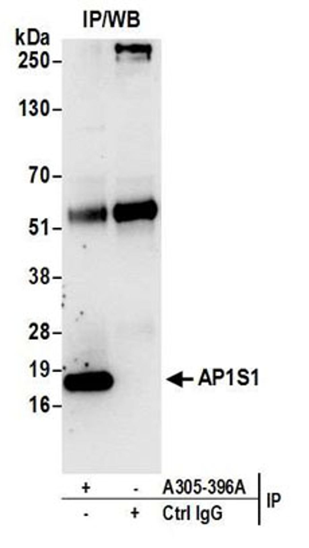 Detection of human AP1S1 by western blot of immunoprecipitates.