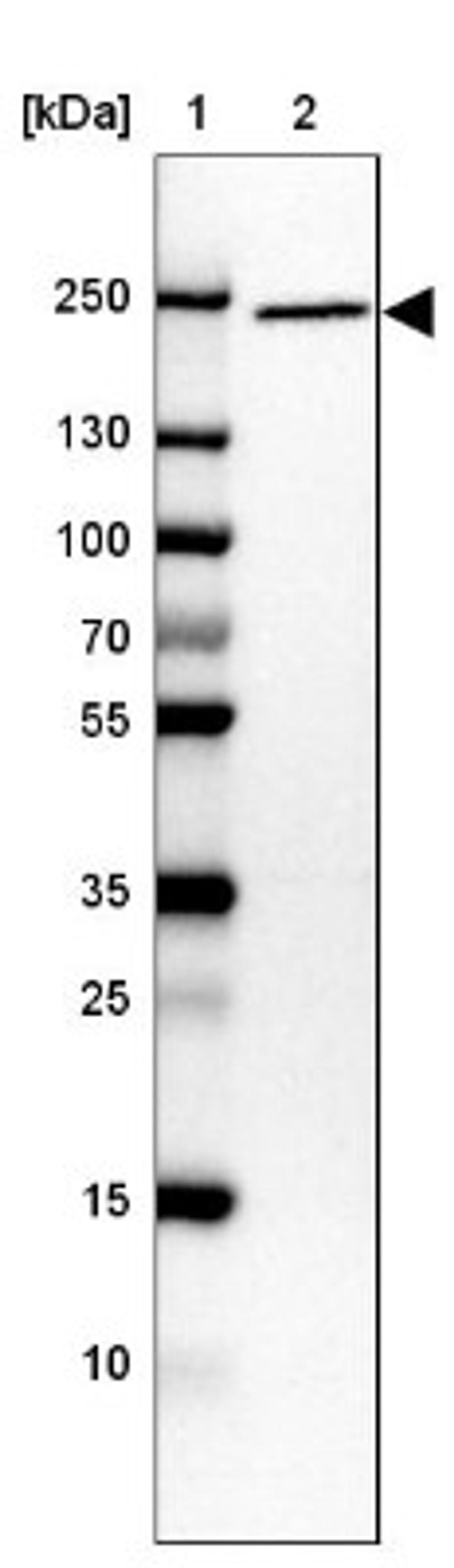 Western Blot: ARFGEF2 Antibody [NBP1-88607] - Lane 1: Marker [kDa] 250, 130, 100, 70, 55, 35, 25, 15, 10<br/>Lane 2: CACO-2