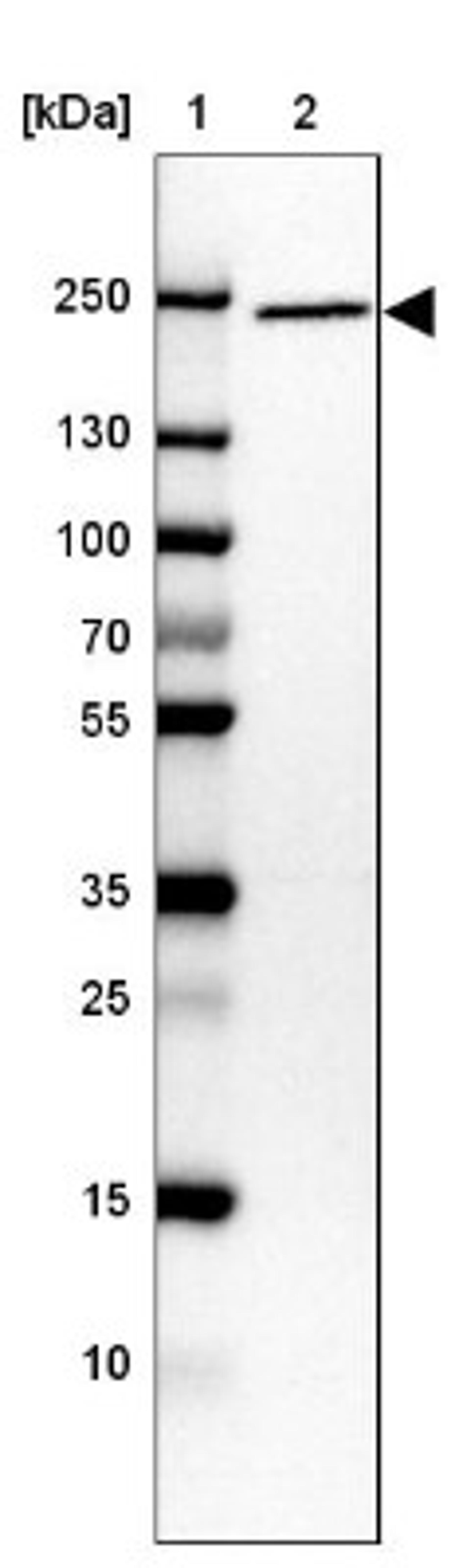 Western Blot: ARFGEF2 Antibody [NBP1-88607] - Lane 1: Marker [kDa] 250, 130, 100, 70, 55, 35, 25, 15, 10<br/>Lane 2: CACO-2