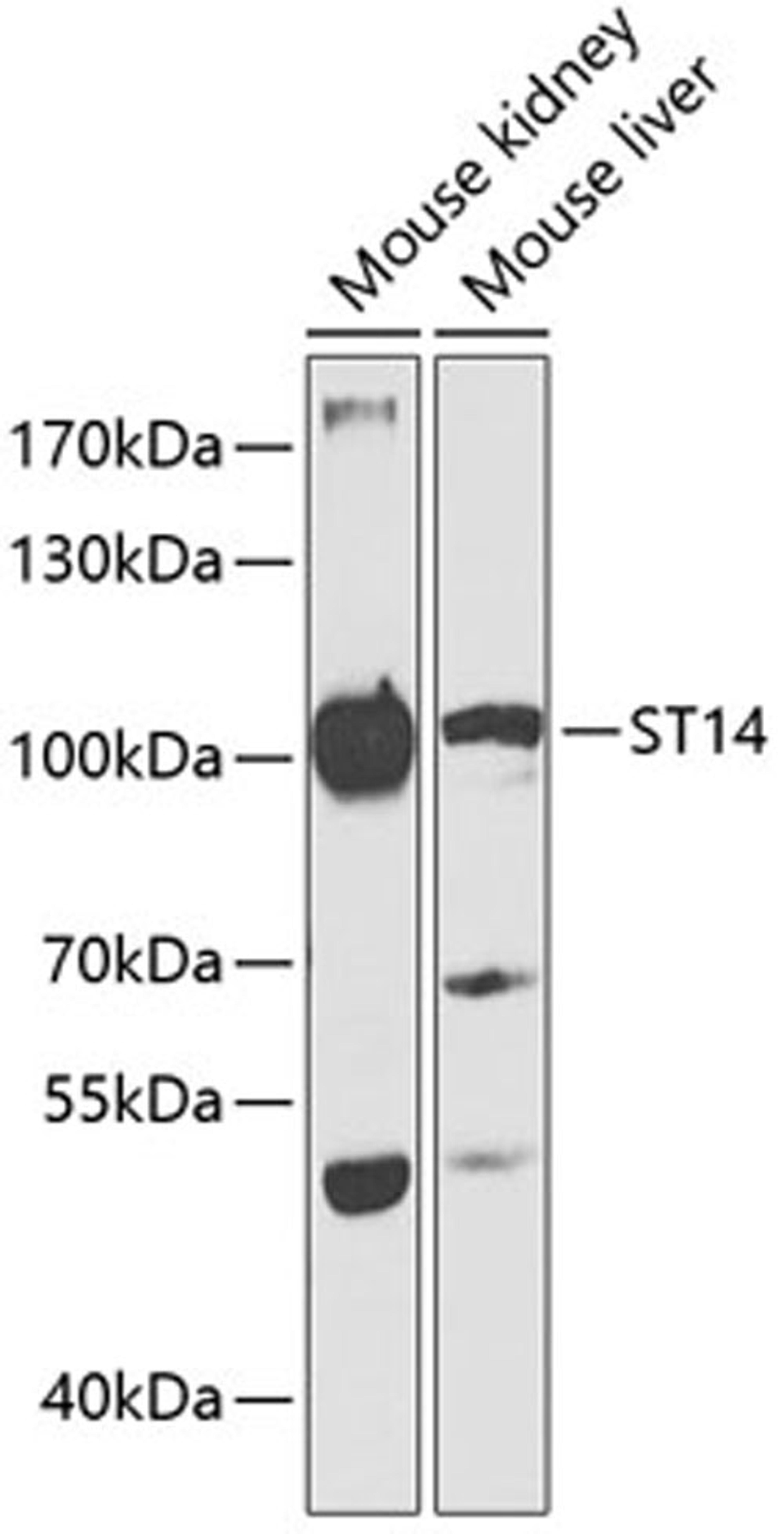 Western blot - ST14 antibody (A13549)