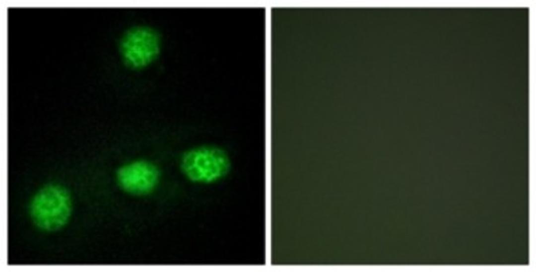 Immunocytochemistry/Immunofluorescence: CLK1 Antibody [NBP1-67948] - Analysis of HuvEc cells, using CLK1 Antibody. The picture on the right is treated with the synthesized peptide.