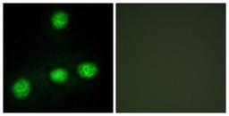 Immunocytochemistry/Immunofluorescence: CLK1 Antibody [NBP1-67948] - Analysis of HuvEc cells, using CLK1 Antibody. The picture on the right is treated with the synthesized peptide.