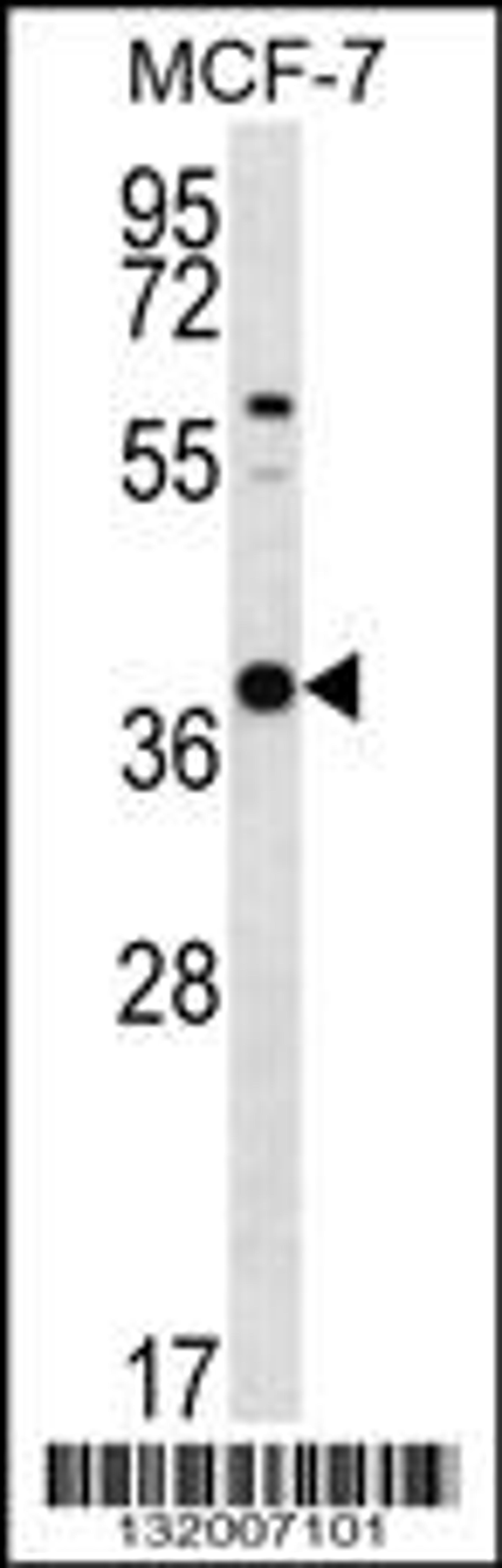 Western blot analysis in MCF-7 cell line lysates (35ug/lane).