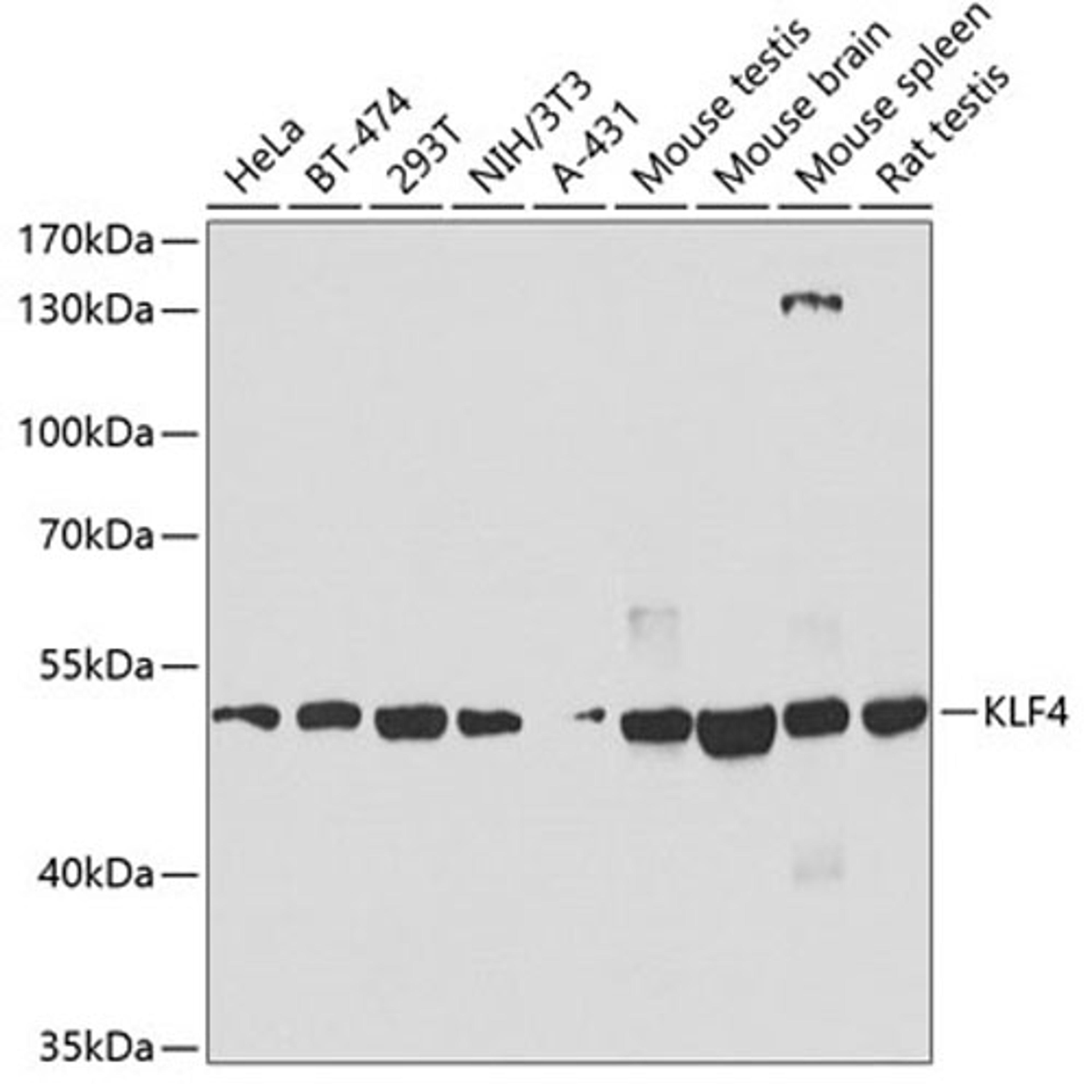 Western blot - KLF4 antibody (A6640)