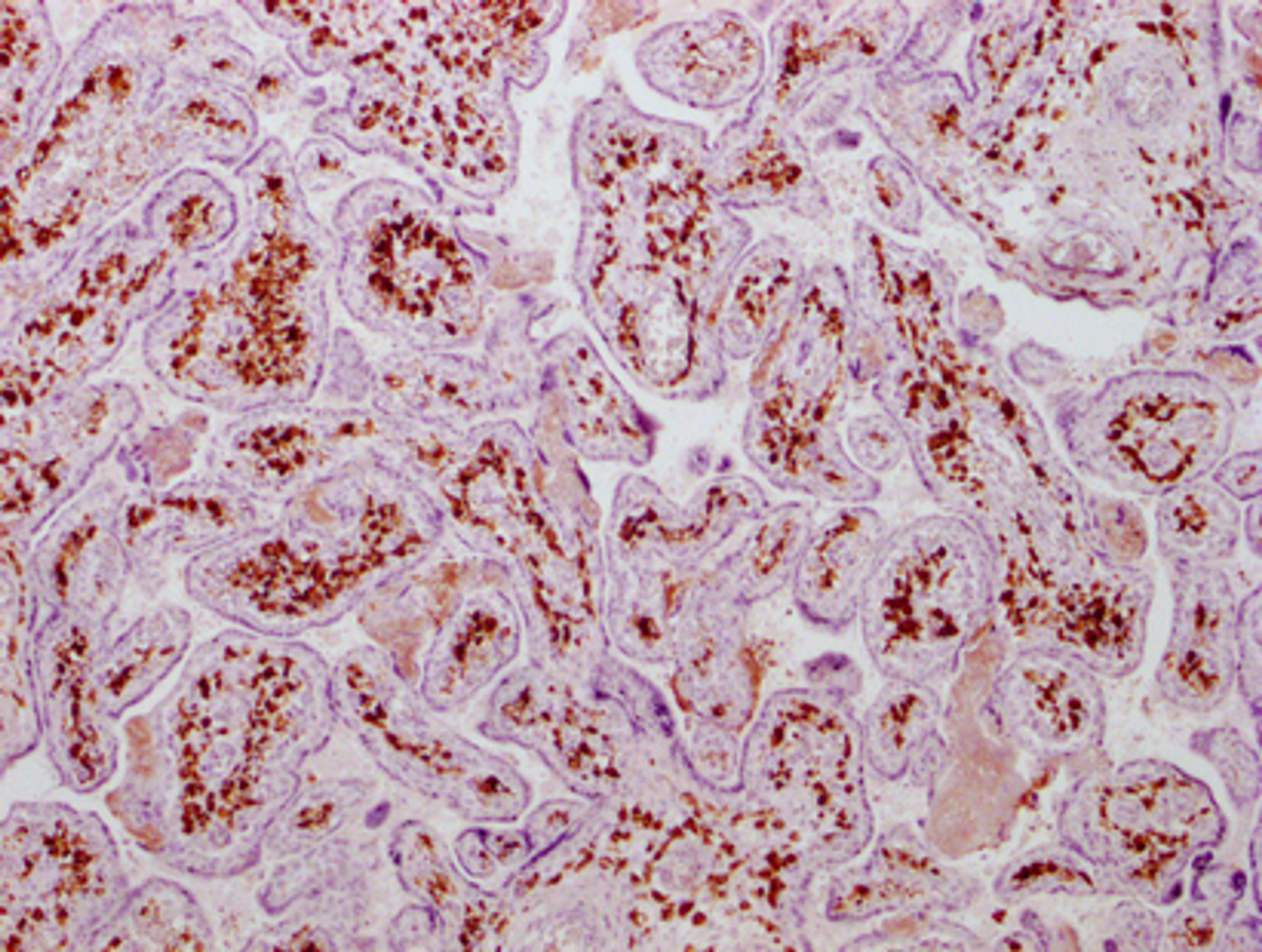 IHC image of CSB-MA177758 diluted at 1:100 and staining in paraffin-embedded human placenta tissue performed on a Leica BondTM system. After dewaxing and hydration, antigen retrieval was mediated by high pressure in a citrate buffer (pH 6.0). Section was blocked with 10% normal goat serum 30min at RT. Then primary antibody (1% BSA) was incubated at 4°C overnight. The primary is detected by a Goat anti-mouse IgG polymer labeled by HRP and visualized using 0.05% DAB.