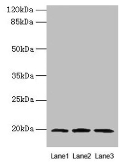 Western blot. All lanes: MRPL49 antibody at 0.6µg/ml. Lane 1: Colo320 whole cell lysate. Lane 2: Mouse liver tissue. Lane 3: Mouse kidney tissue. Secondary. Goat polyclonal to rabbit IgG at 1/10000 dilution. Predicted band size: 20 kDa. Observed band size: 20 kDa