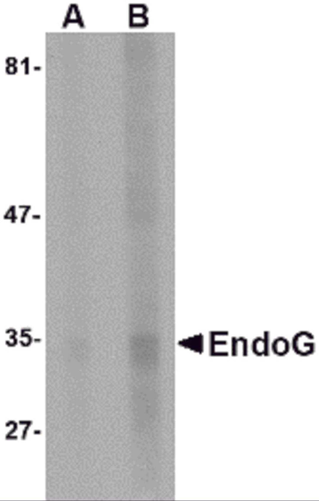 Western blot analysis of EndoG expression in HepG2 cell lysate with EndoG antibody at (A) 5 and (B) 10 &#956;g/mL.