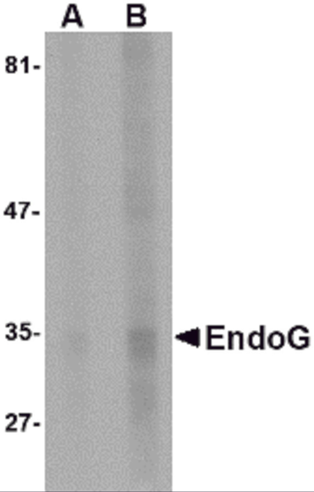 Western blot analysis of EndoG expression in HepG2 cell lysate with EndoG antibody at (A) 5 and (B) 10 μg/mL.