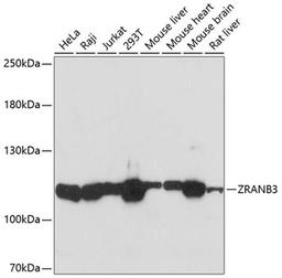 Western blot - ZRANB3 antibody (A9555)