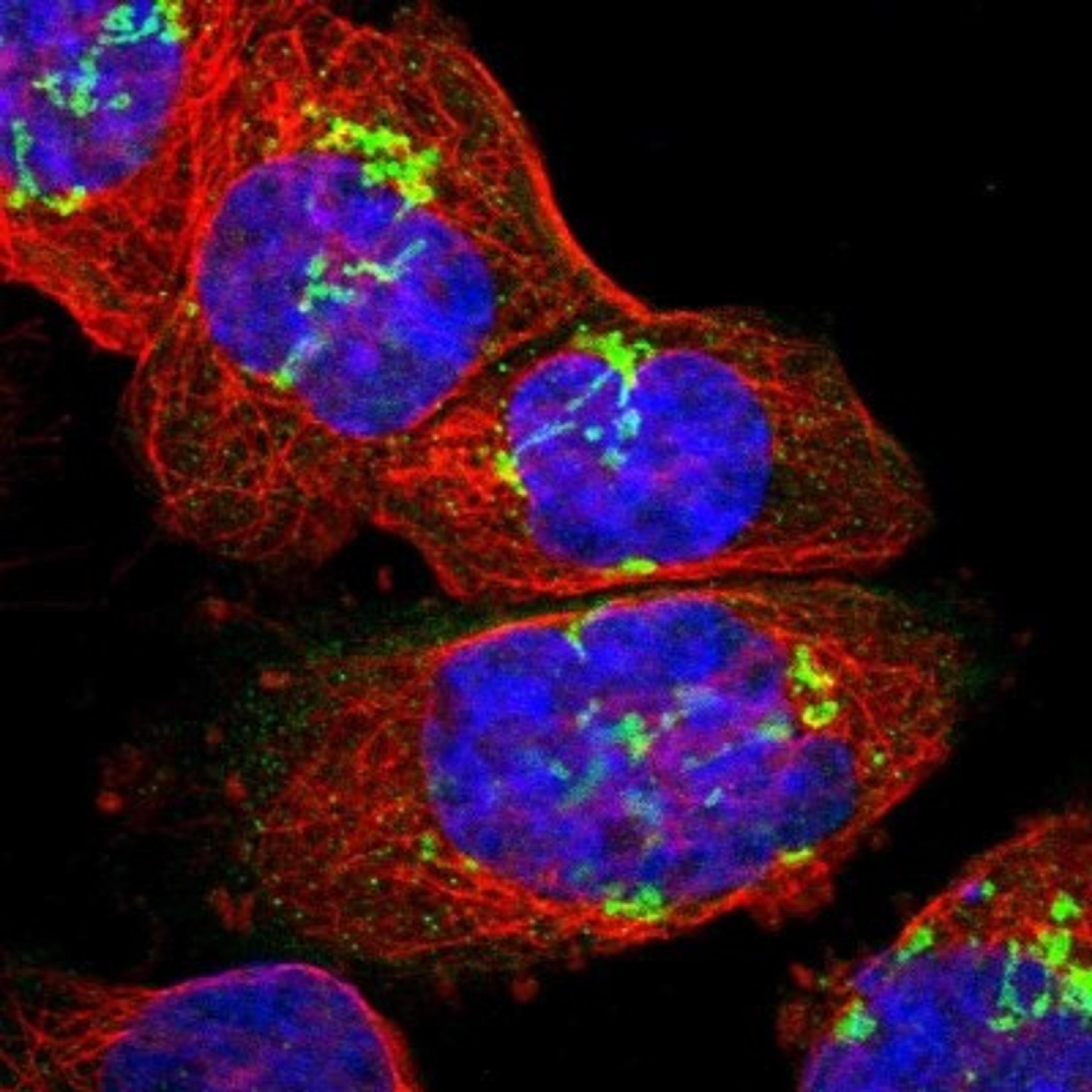 Immunocytochemistry/Immunofluorescence: SLC35E1 Antibody [NBP1-94009] - Staining of human cell line A-431 shows positivity in golgi.