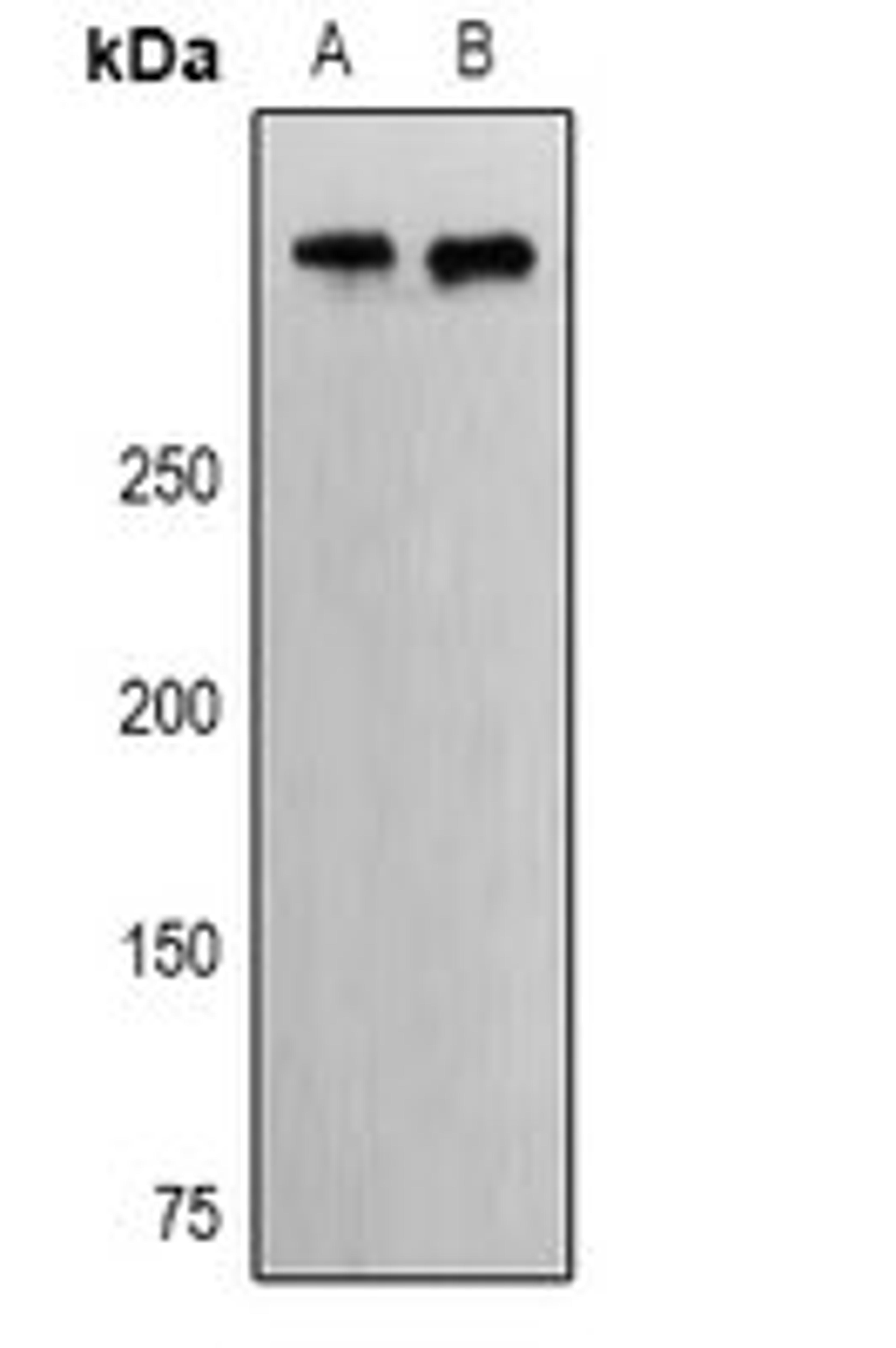 Western blot analysis of Hela (Lane1), Jurkat (Lane2) whole cell lysates using EP400 antibody