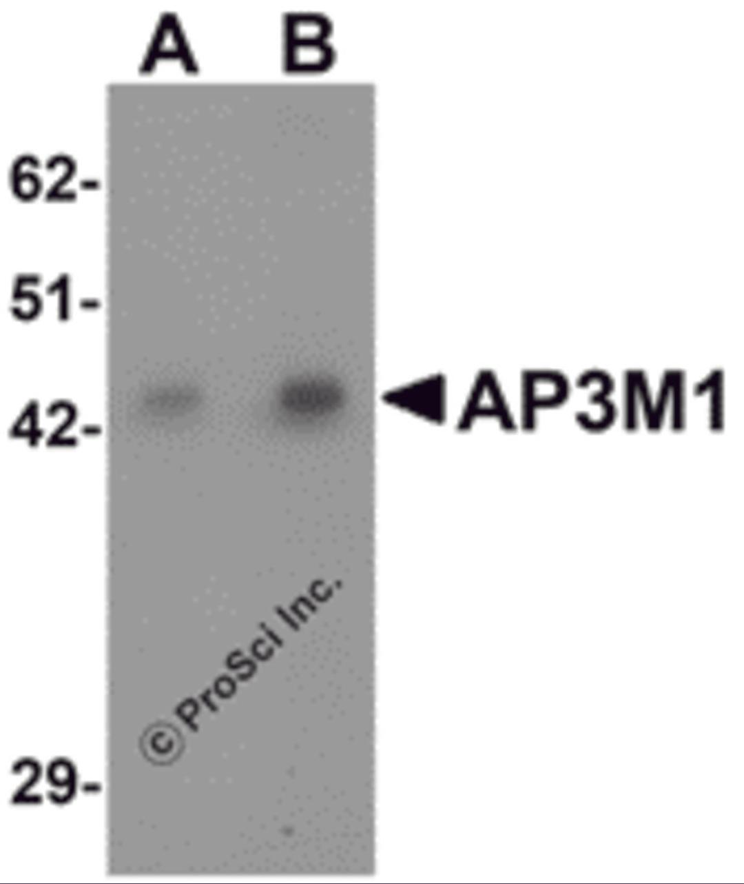 Western blot analysis of AP3M1 in human brain tissue lysate with AP3M1 antibody at (A) 1 and (B) 2 μg/mL .