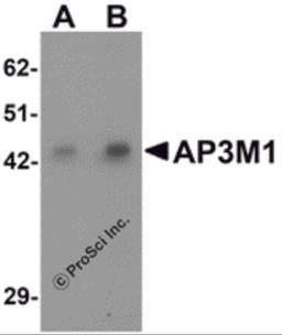 Western blot analysis of AP3M1 in human brain tissue lysate with AP3M1 antibody at (A) 1 and (B) 2 μg/mL .