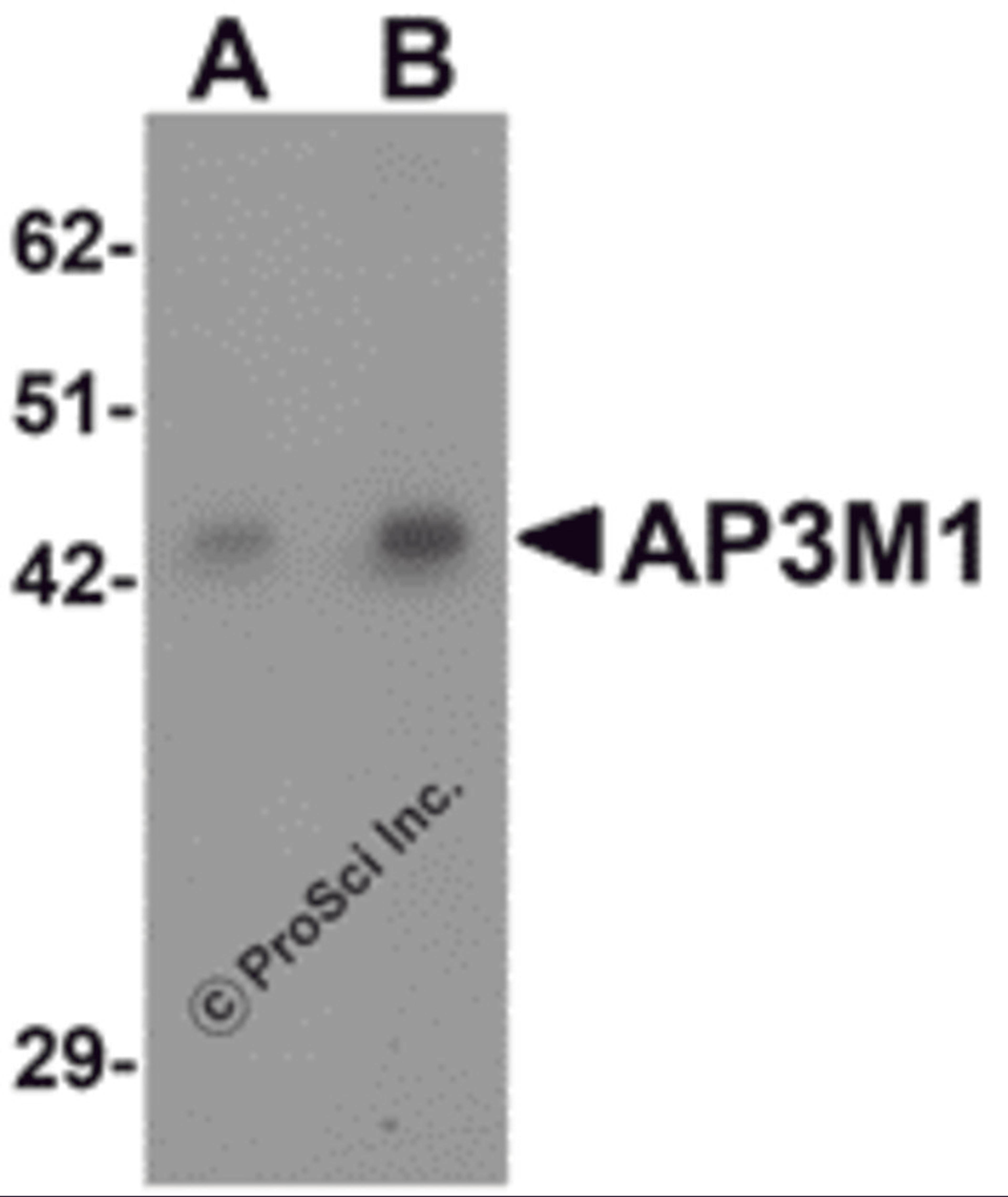 Western blot analysis of AP3M1 in human brain tissue lysate with AP3M1 antibody at (A) 1 and (B) 2 μg/mL .
