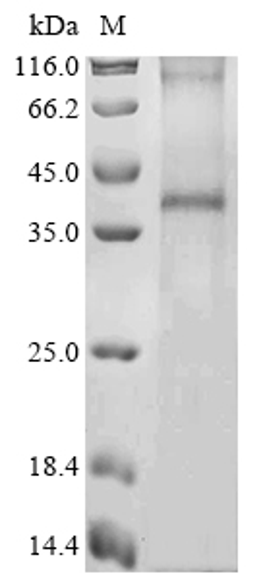 (Tris-Glycine gel) Discontinuous SDS-PAGE (reduced) with 5% enrichment gel and 15% separation gel.