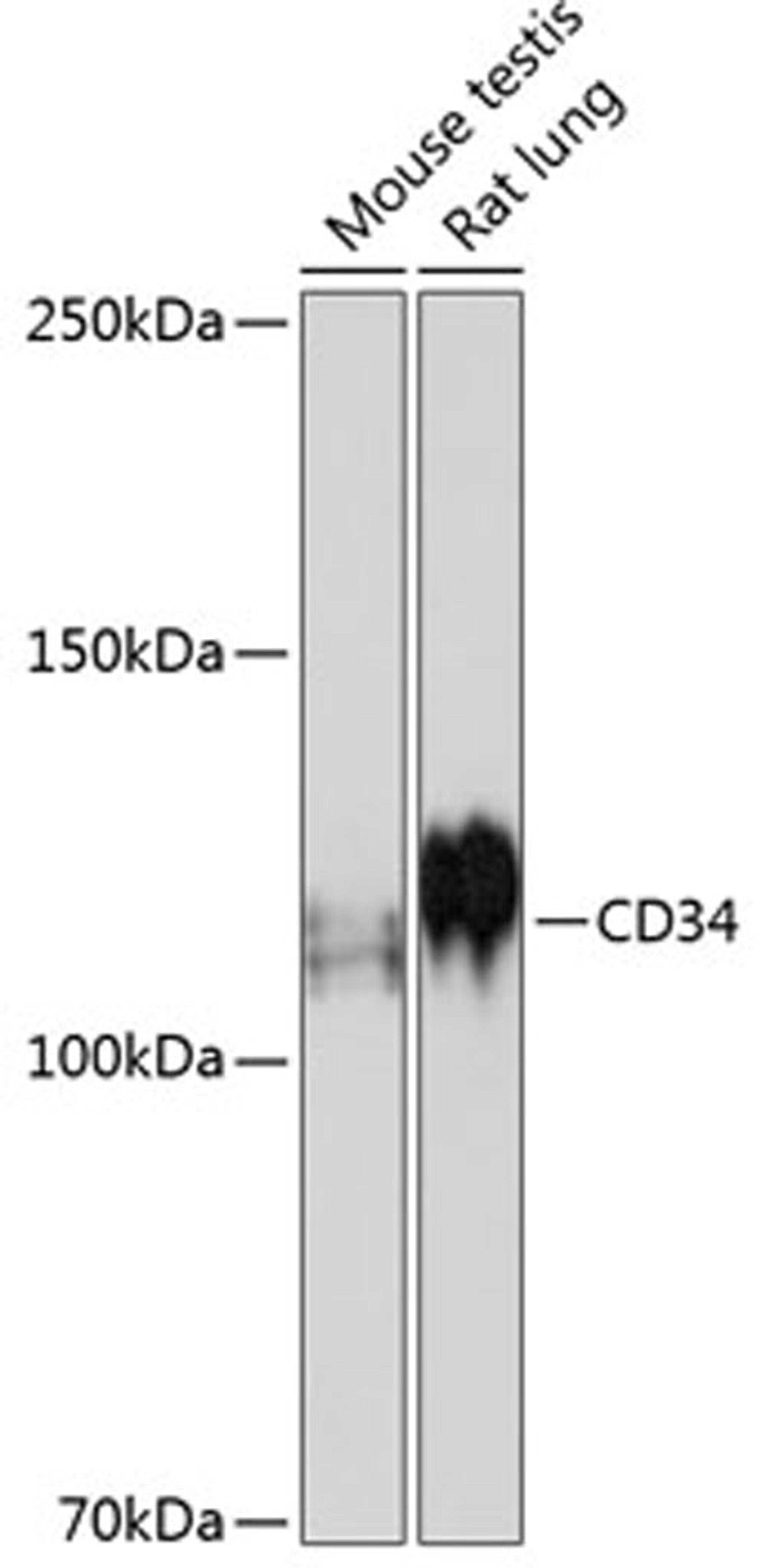 Western blot - CD34 antibody (A19015)