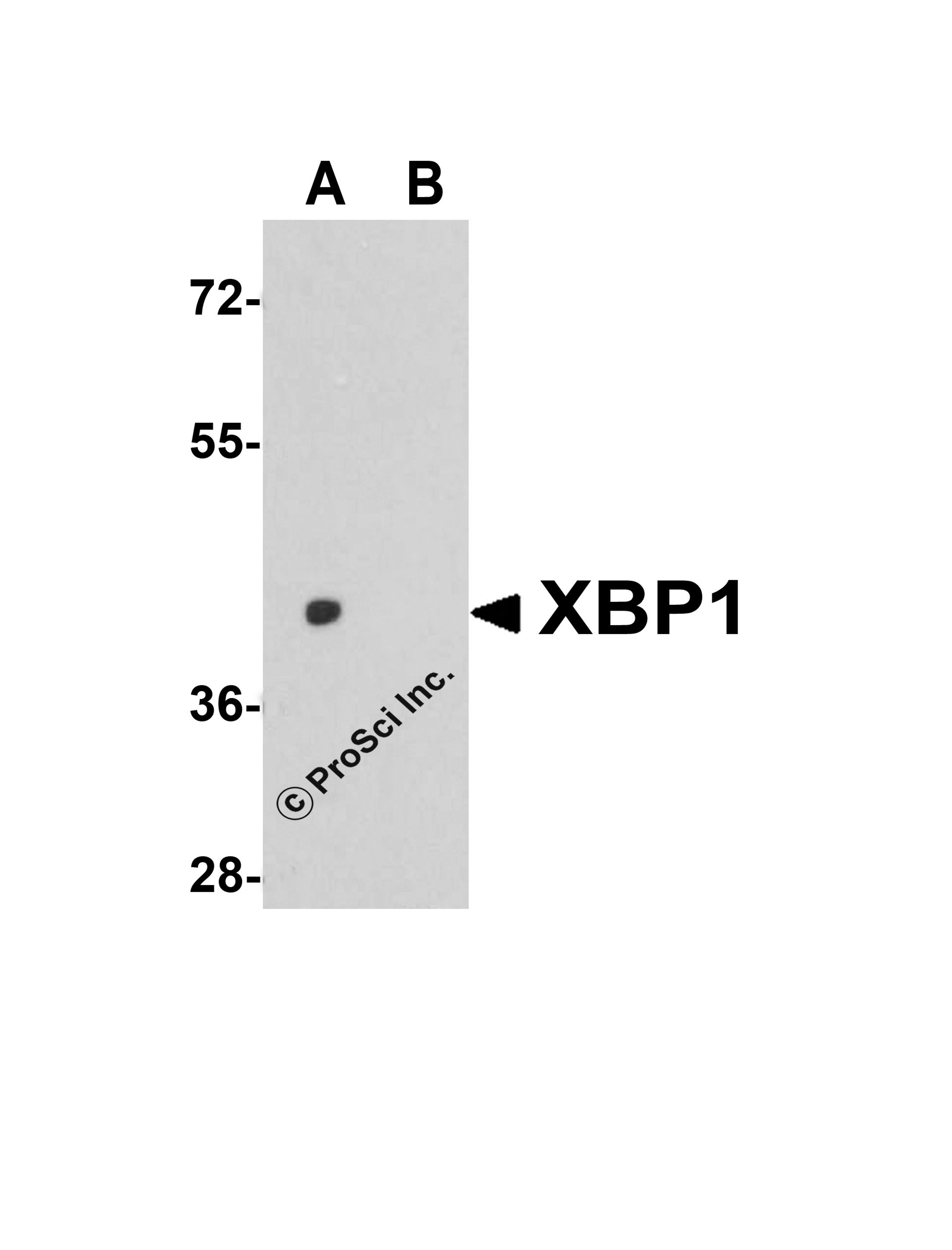 Western blot analysis of XBP-1 in HepG2 cell lysate with XBP-1 antibody at 1 μg/mL in (A) the absence and (B) the presence of blocking peptide