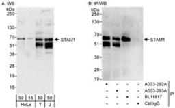 Detection of human STAM1 by western blot and immunoprecipitation.